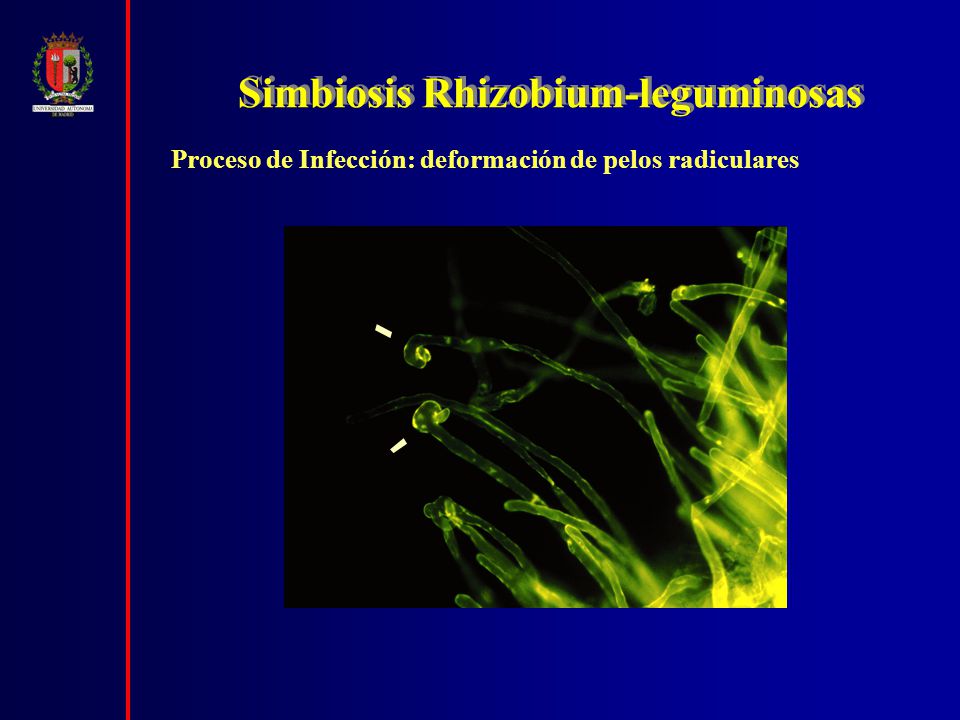 infección humana por rizobio
